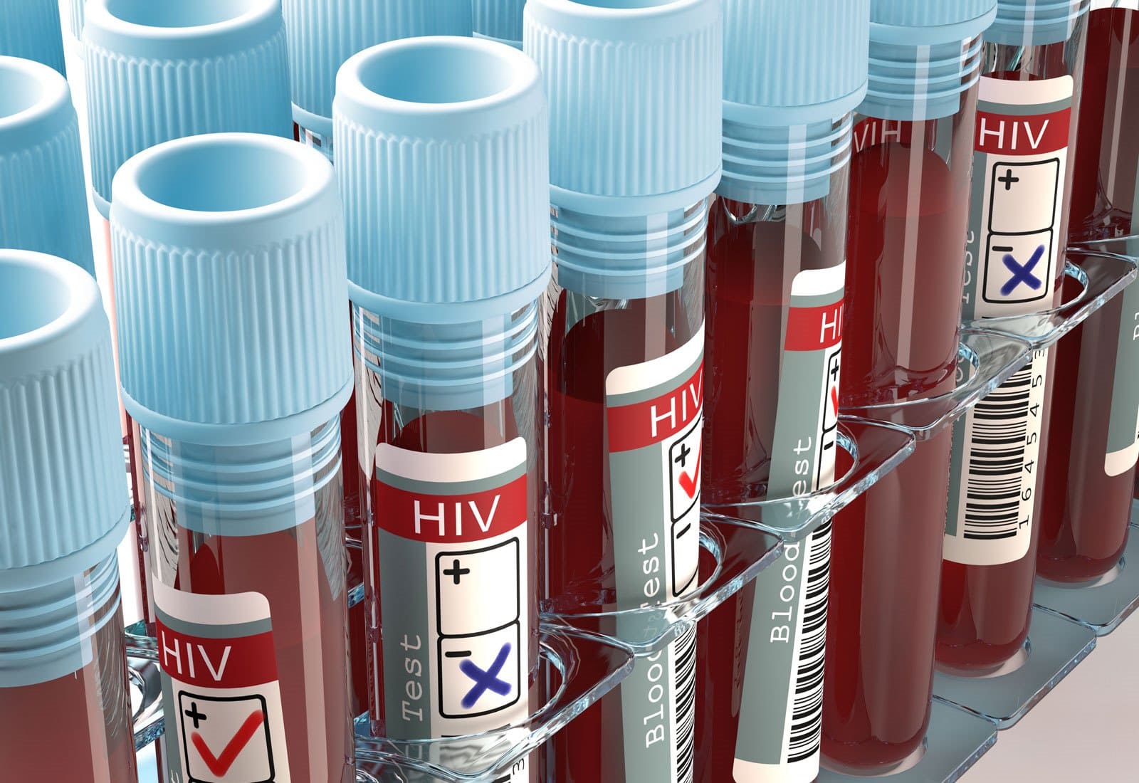 HIV-AIDS-blood-test