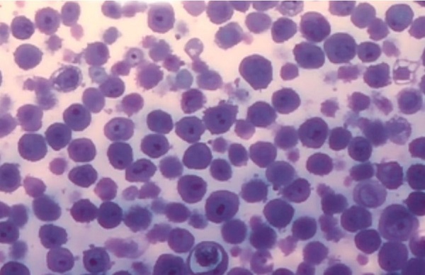 Новосибирские ученые представили препарат для терапии воспаления внутренних органов Новосибирские ученые представили препарат для терапии воспаления внутренних органов