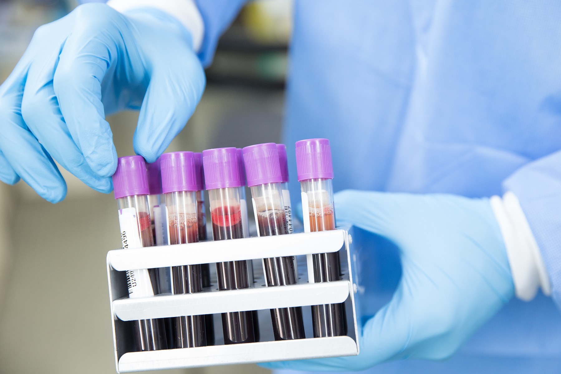 blood-lab-tests
