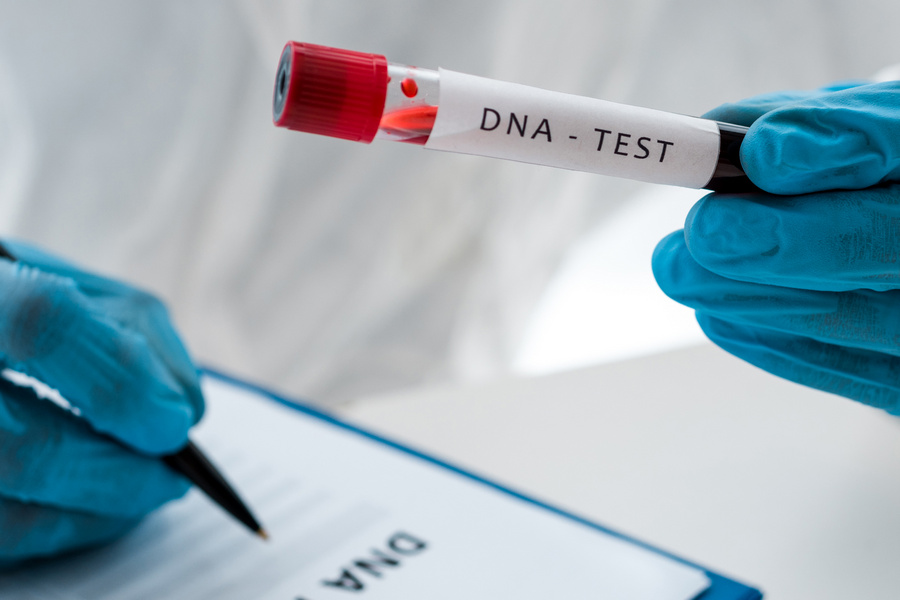 dna test dna test