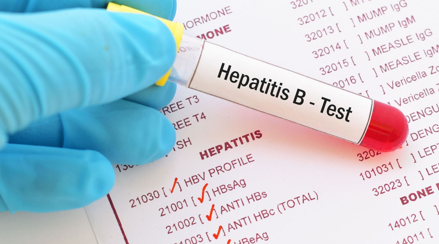 hepatitis-b