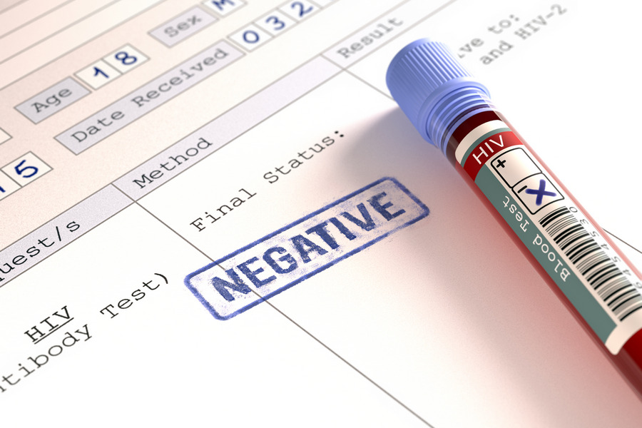 HIV Negative HIV Negative
