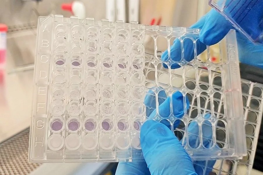 НМИЦ гематологии готовится к выпуску отечественного препарата для CAR-T-терапии НМИЦ гематологии готовится к выпуску отечественного препарата для CAR-T-терапии