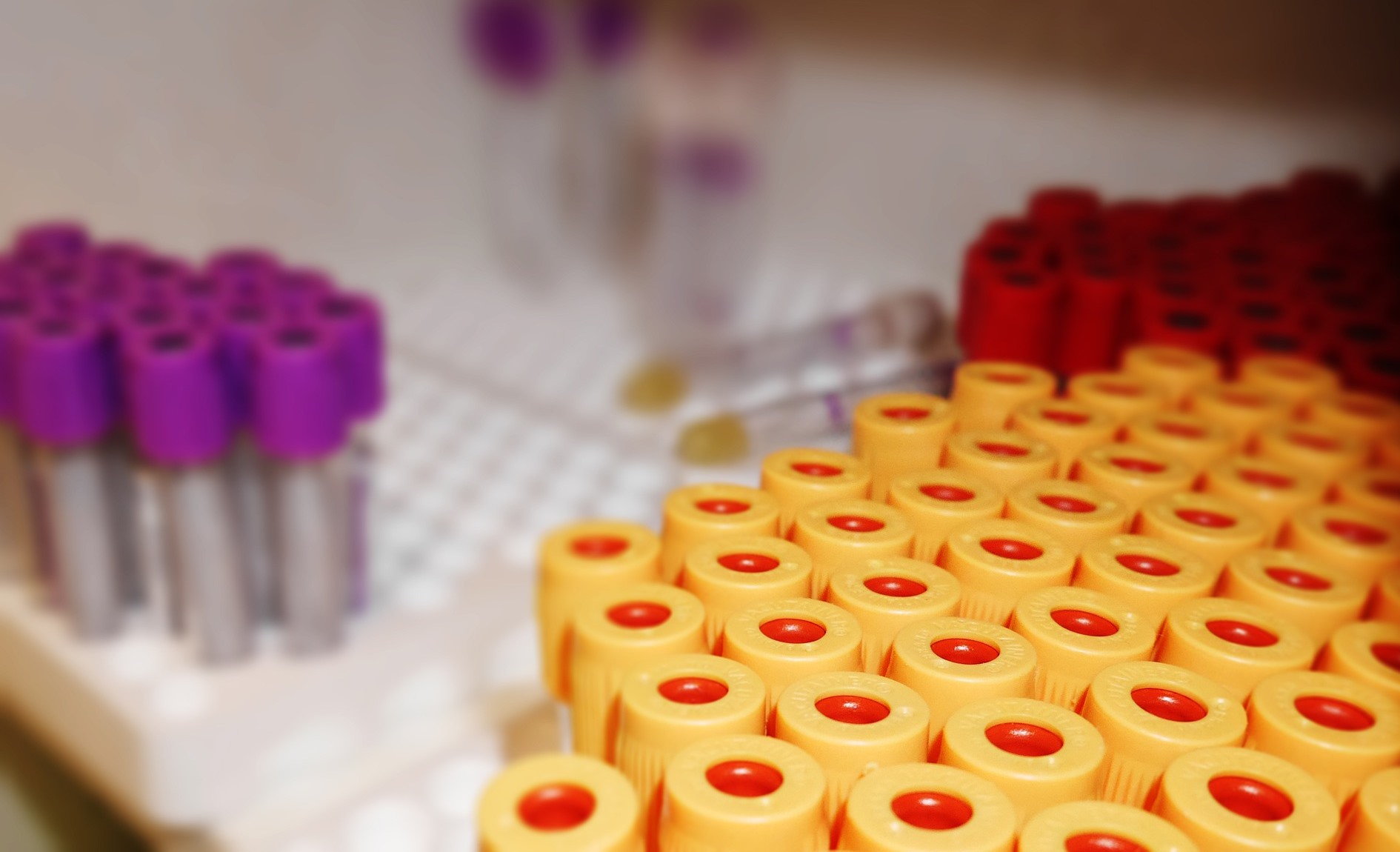 laboratory-probirki Лаборатория, пробирки