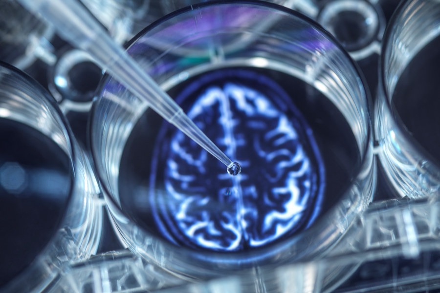 Pipetting potential cure for brain disorders into a multi well plate Pipetting potential cure for brain disorders into a multi well plate