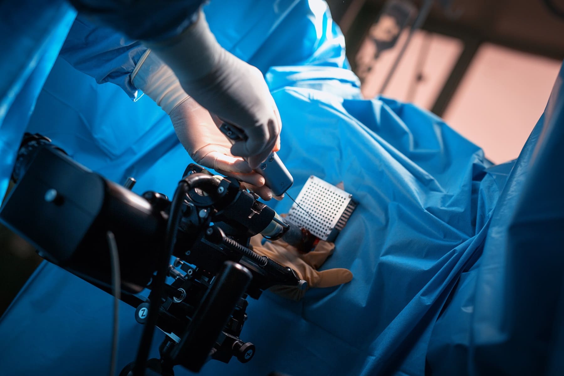 radiologia-brahiterapia-rostech