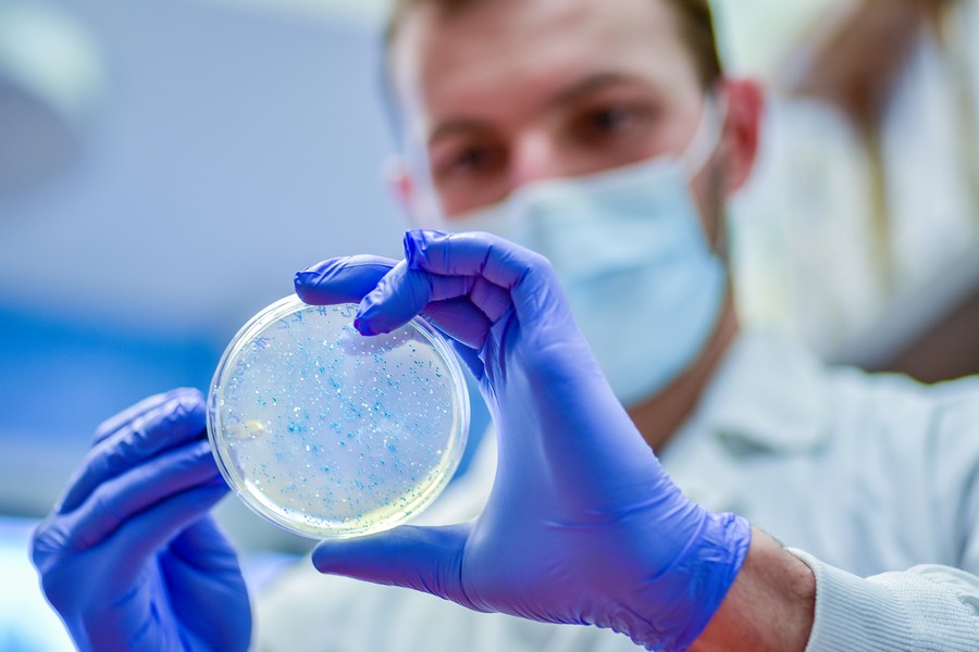 researcher-examine-bacterial-culture-plate
