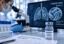 Экспресс-диагностика и новые вакцины: эксперты прокомментировали данные о штамме туберкулеза EurA1.1 Вакцины против туберкулеза
